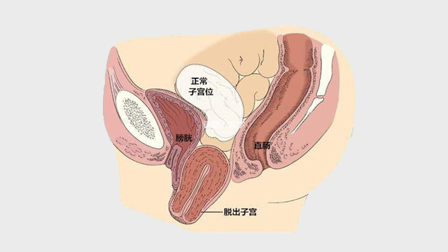 產后修復服務