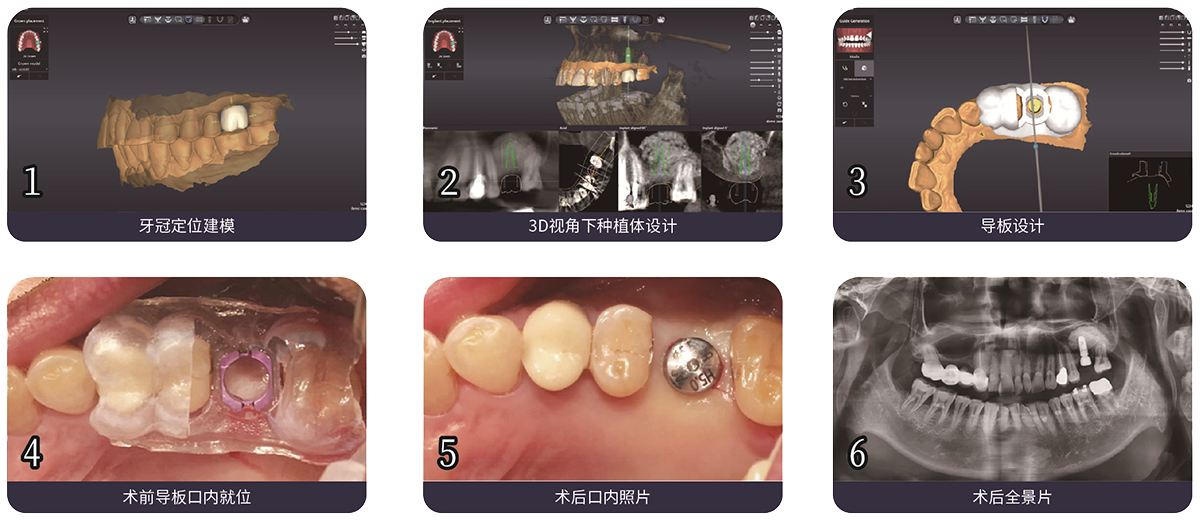 這是描述信息