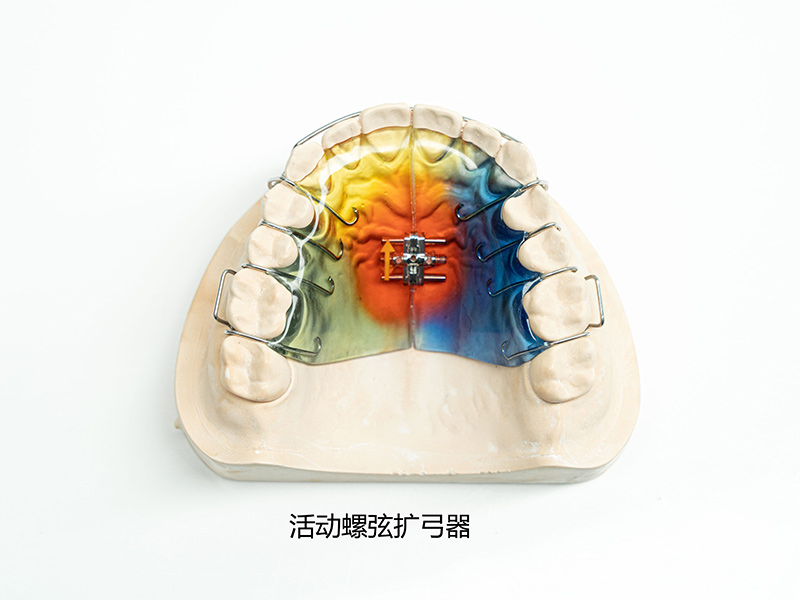 活動螺弦擴弓器