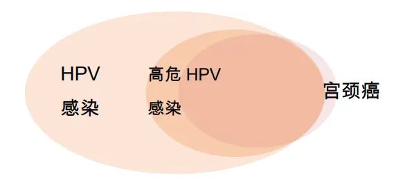 高危HPV病毒感染是引發宮頸癌的必要條件