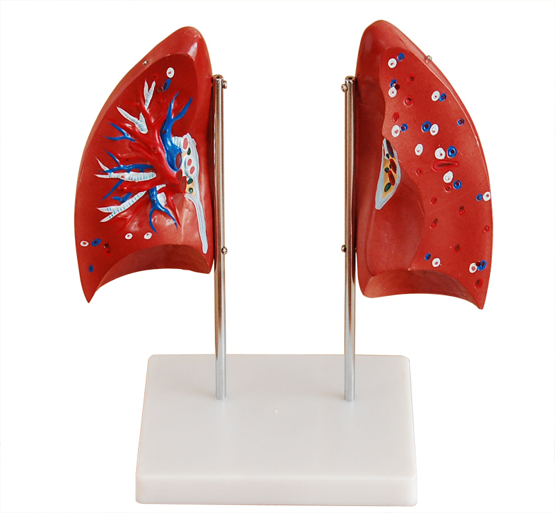  肺解剖模型